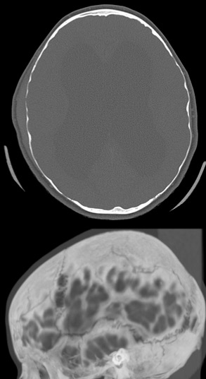 hydro tdm wignacourt