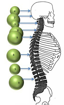 kyste neurentérique niveau