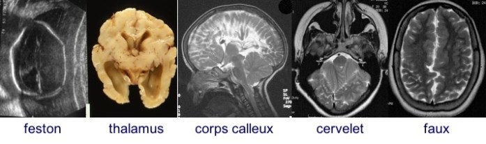 MM pôle céphalique