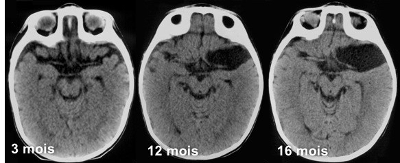 sylvien développement