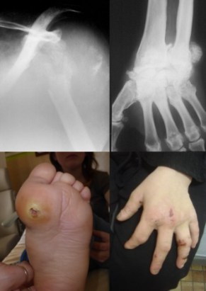 syrinx tr trophiques