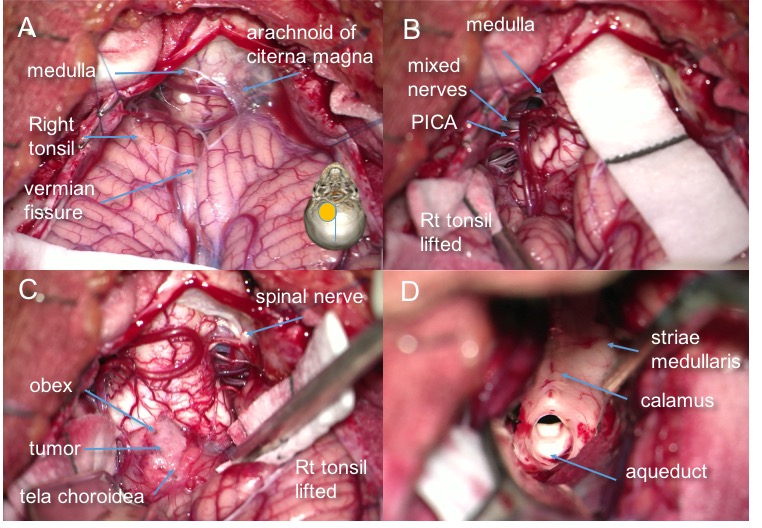inter-télo-vélaire