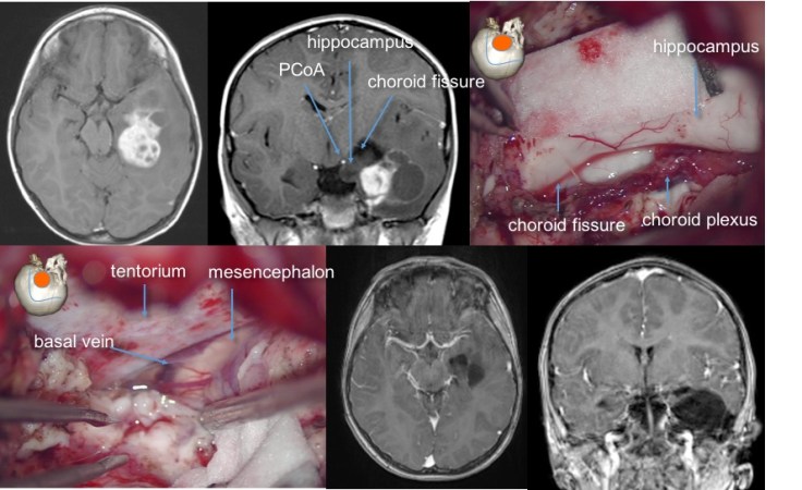 Barbieux ggg temporal