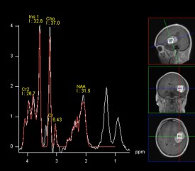 Verstaevel Eve 17Nov21 spectro.jpg