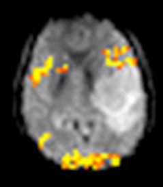 Verstaevel Eve 17Nov22 langage
