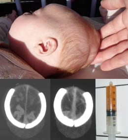 collection sous-galéale bis