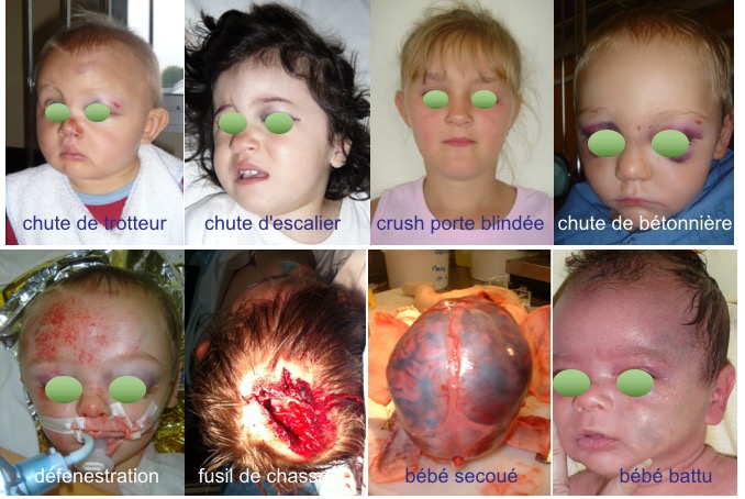 trauma médico-social