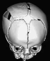 Lemort tdm 3D 001.jpg