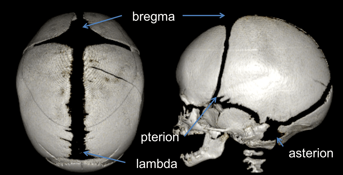 fontanelles.png