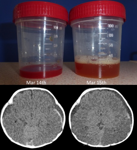 PSD aspect du liquide