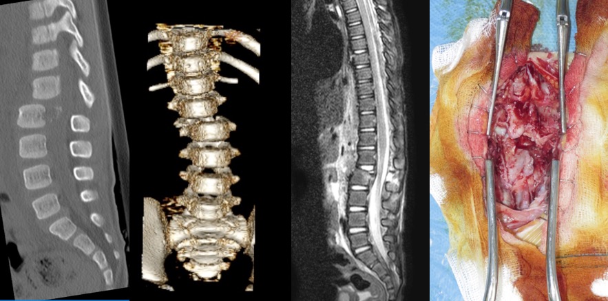 Felix Louna L1L2 Silverman