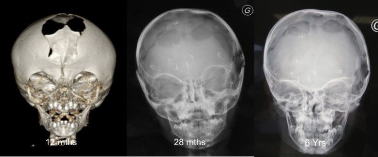 formanina permagna Saethre