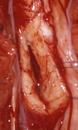 Marie dents de peigne