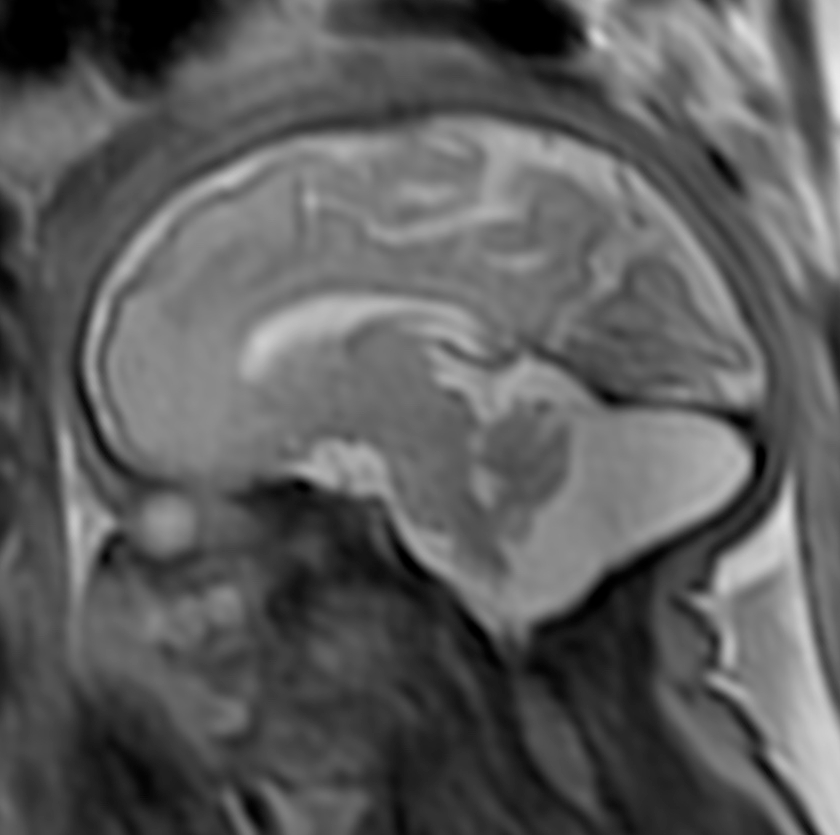 méga-grande citerne