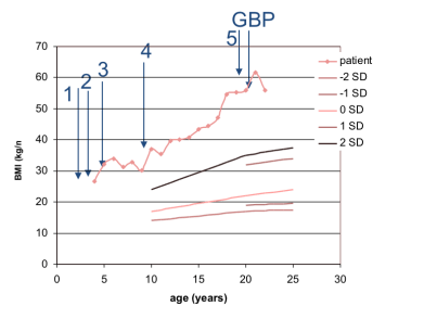 cranio obésité Wozak