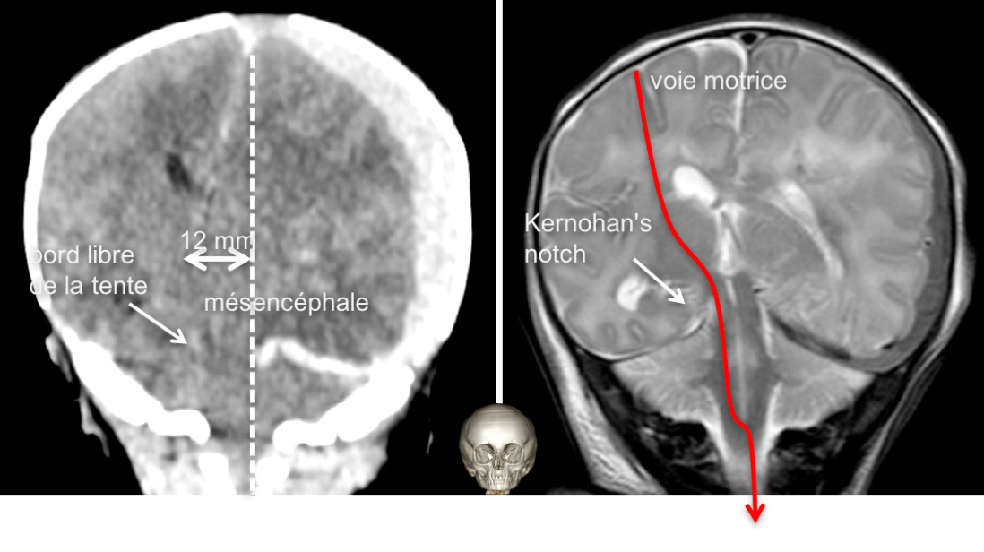 engagement Kernohan.png