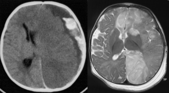 engagement sous-falco Wargniez