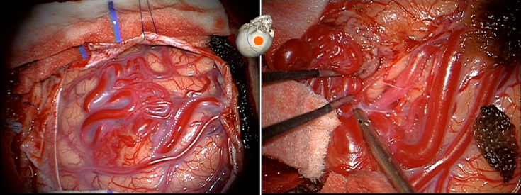 MAV coils &amp; straights
