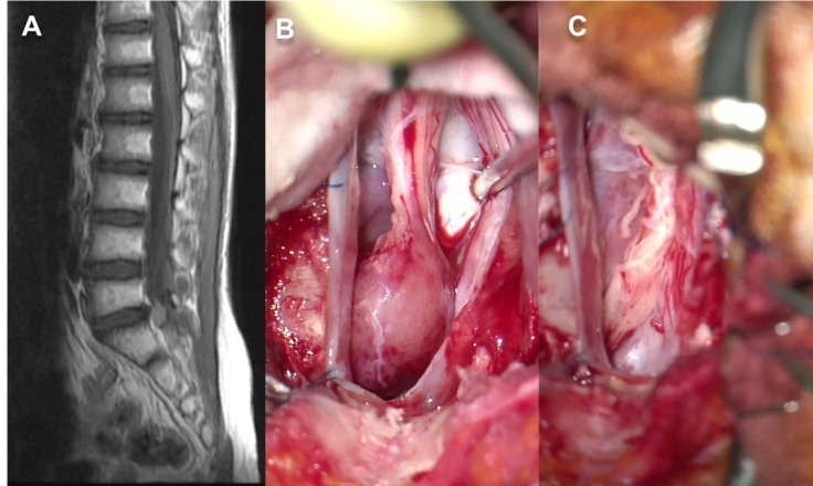 QdeCh méta Cantois